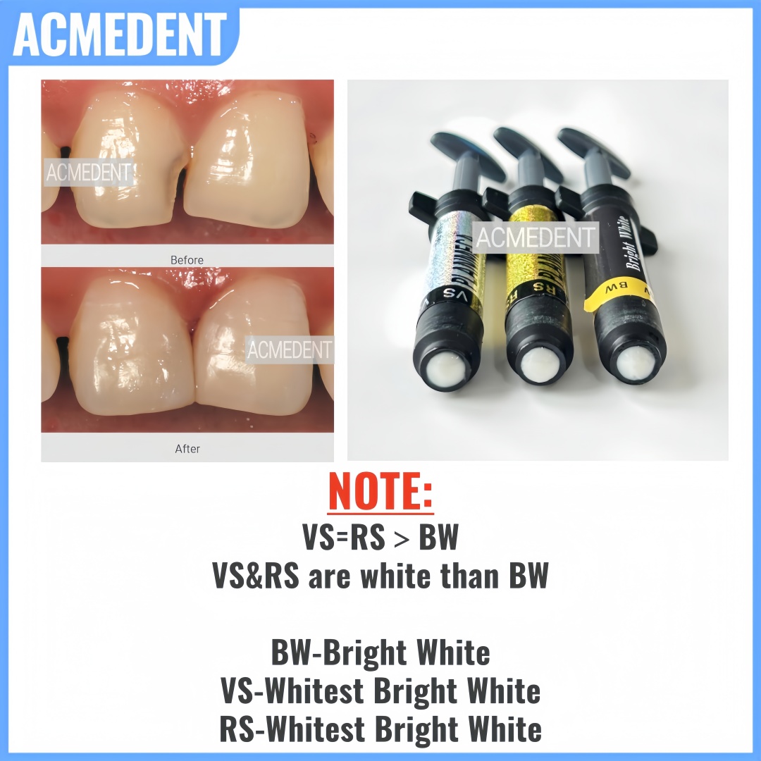 4,5 g Dental-Verbundharzfurnie – Teeth Whitening Vs Veneers Bewertung und Preis