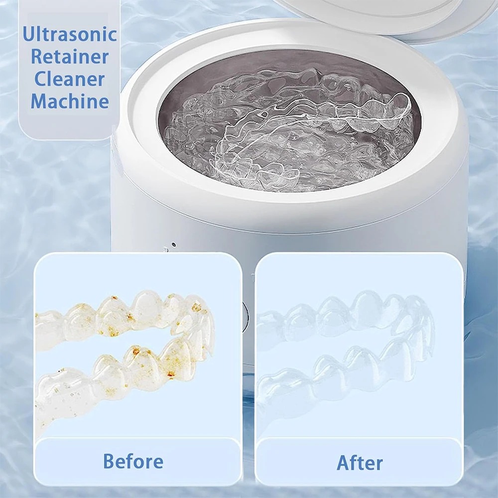 USB-Betriebene Zahnreinigungsg – Teeth Whitening Device Bewertung und Preis